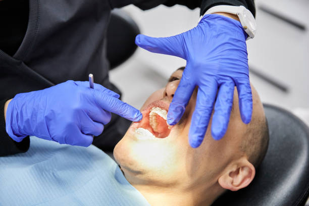Best Emergency Dentist for Lost Fillings or Crowns in Bessemer, MI